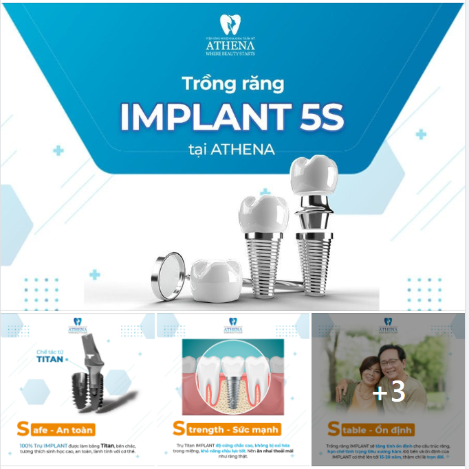 TRỌN ĐỜI ĂN NGON NGỦ KĨ KHI TRỒNG RĂNG IMPLANT 5S TẠI VIỆN CÔNG NGHỆ NHA KHOA THẨM MỸ ATHENA !!!