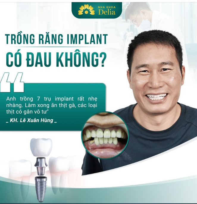 Trồng Răng Implant - An Toàn, Không Đau