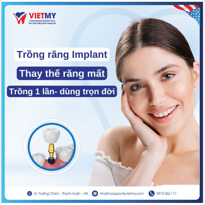 TRỒNG RĂNG IMPLANT CHẮC KHỎE NHƯ RĂNG THẬT- TRỒNG 1 LẦN DÙNG CẢ ĐỜI