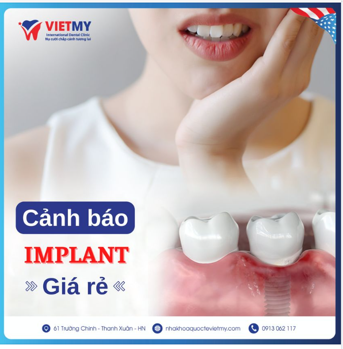 TRỒNG RĂNG IMPLANT - CHỌN GIÁ RẺ HAY CHỌN ĐỊA CHỈ NHA KHOA UY TÍN