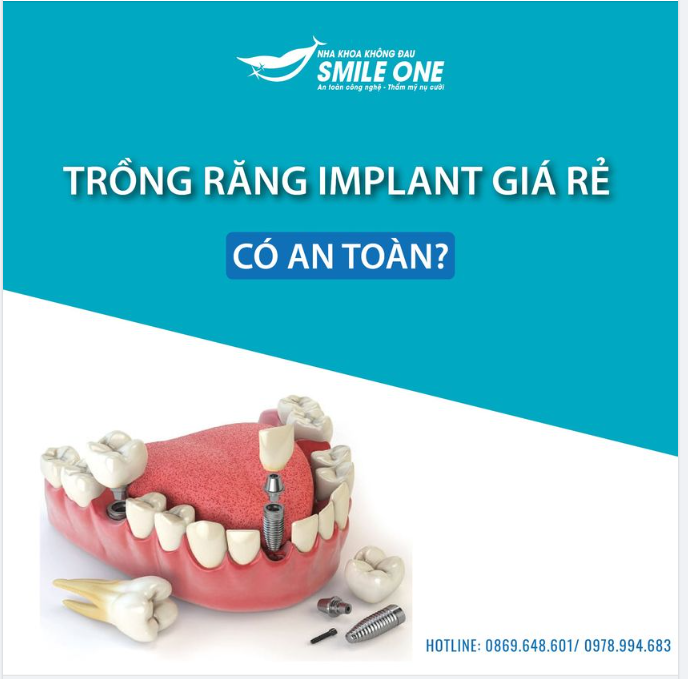 TRỒNG RĂNG IMPLANT GIÁ RẺ CÓ ĐẢM BẢO AN TOÀN?