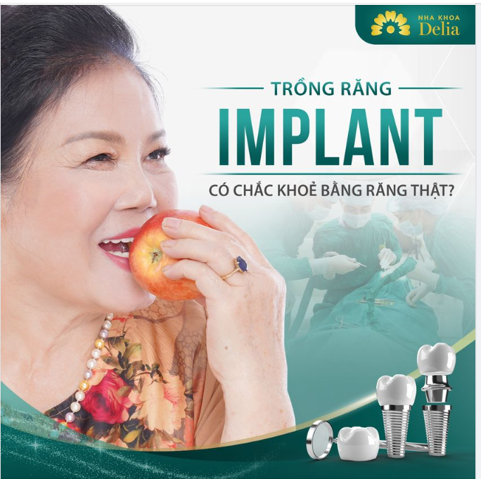 TRỒNG RĂNG IMPLANT - thoải mái ăn nhai, bền chắc trọn đời