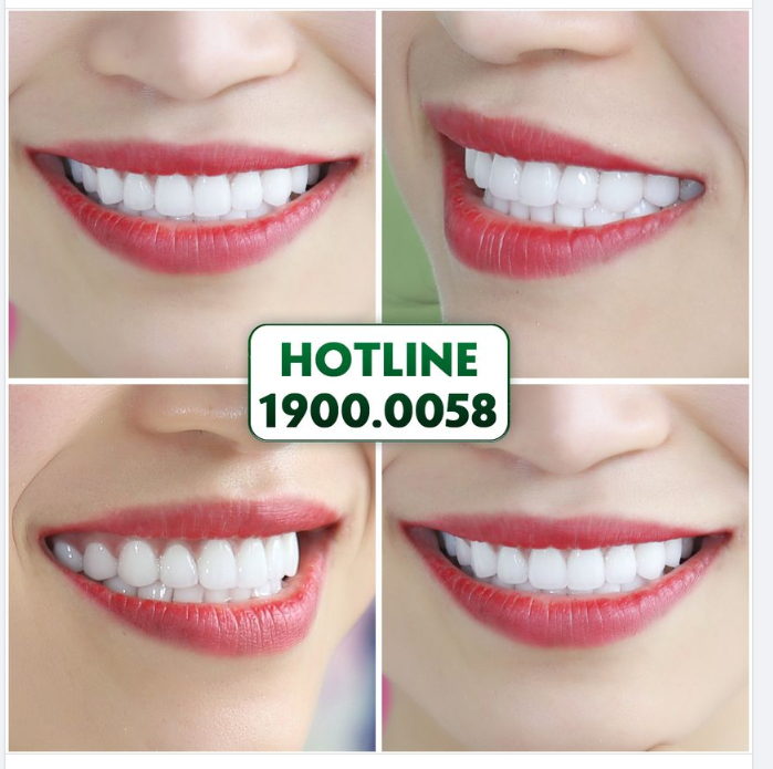 TRƯỚC ĐÂY VUI ĐẾN MẤY CŨNG KHÔNG DÁM CƯỜI, GIỜ THÌ THOẢI MÁI CƯỜI TƯƠ