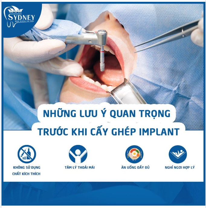 TRƯỚC KHI CẤY GHÉP IMPLANT CẦN LƯU Ý NHỮNG GÌ?
