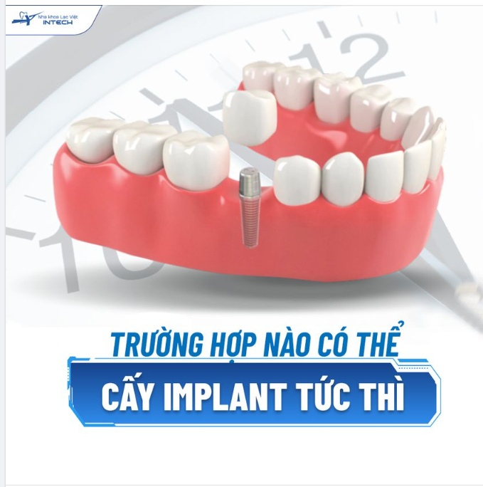 TRƯỜNG HỢP NÀO CÓ THỂ CẤY IMPLANT TỨC THÌ 