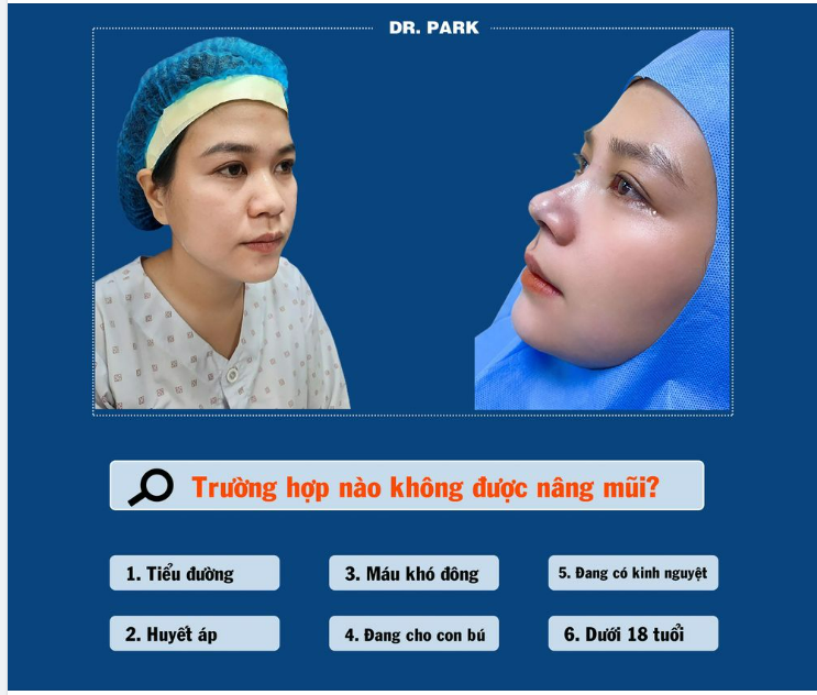 TRƯỜNG HỢP NÀO KHÔNG NÊN NÂNG MŨI