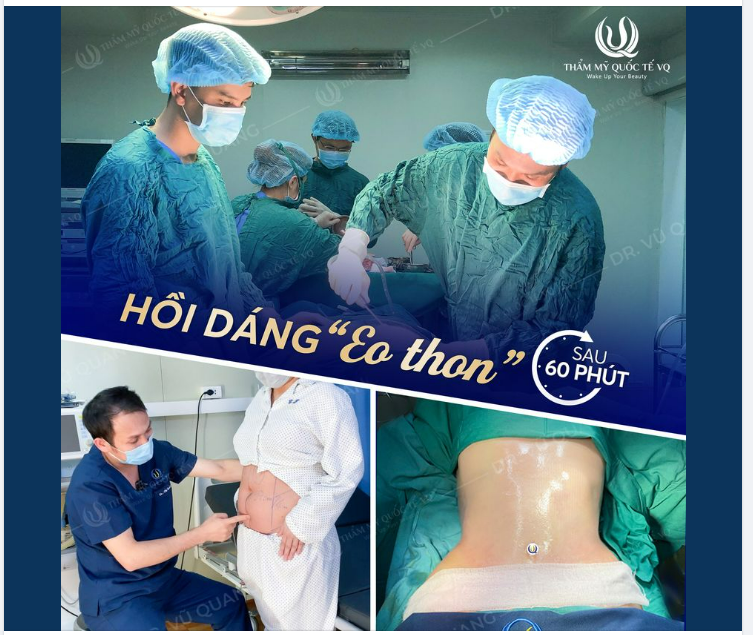 Trút sạch hơn 20cm Vòng 2 - Tức tốc về dáng với Hút mỡ Body Jet Extra.