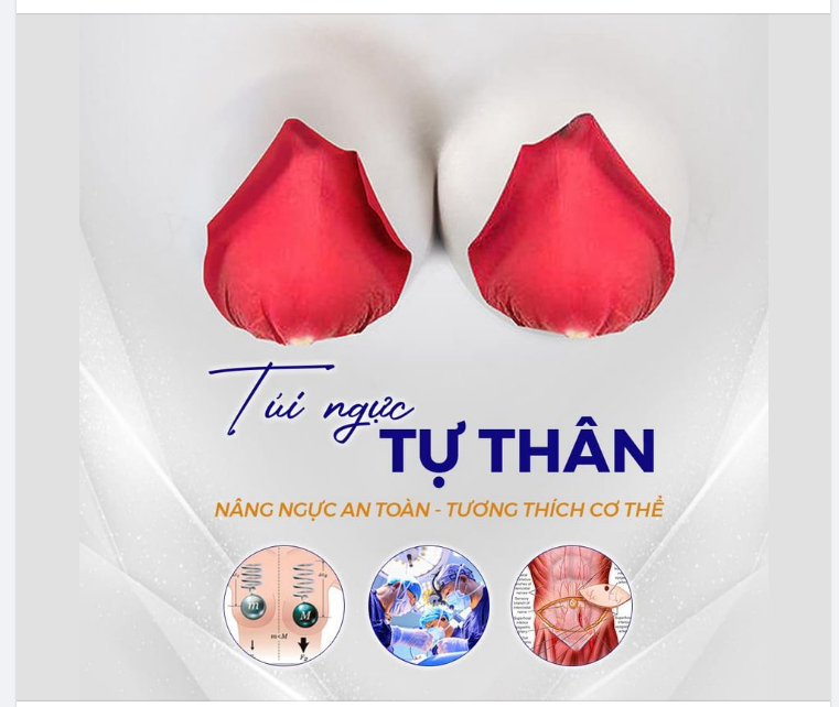 TÚI NGỰC TỰ THÂN LÀ GÌ