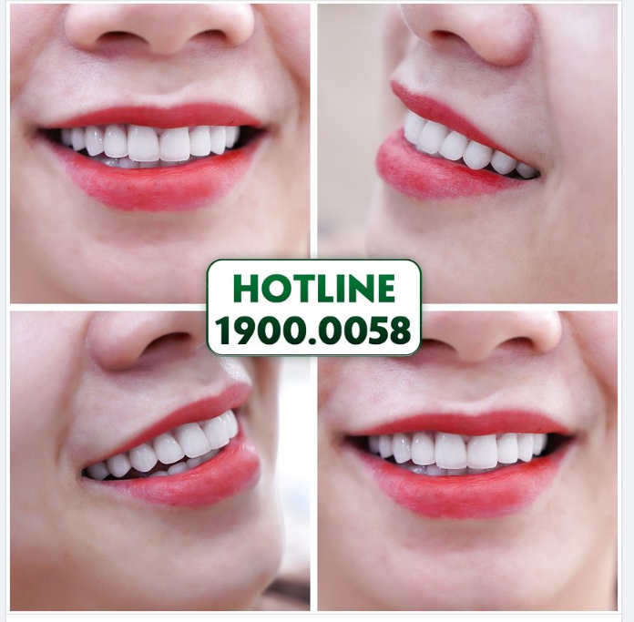 TUYỆT TÁC ĐẾN TỪ ĐÔI BÀN TAY TÀI HOA CỦA BÁC SĨ NHA KHOA GIA ĐÌNH