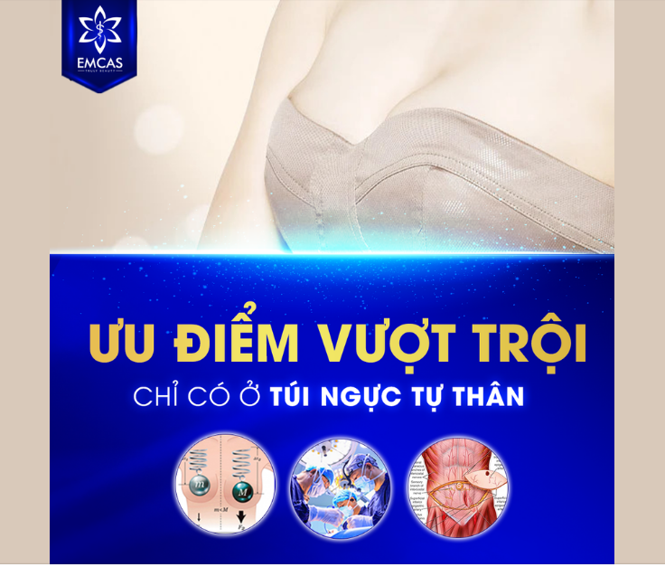 ƯU ĐIỂM VƯỢT TRỘI CHỈ CÓ Ở TÚI NGỰC TỰ THÂN