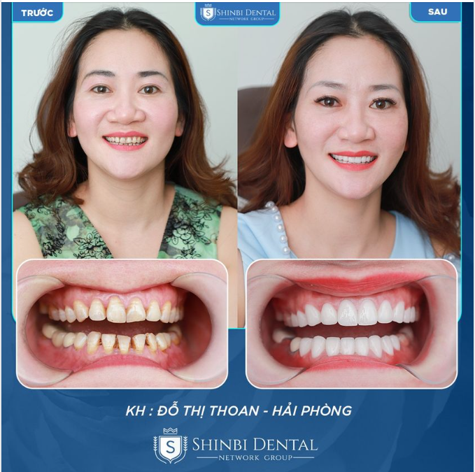 VẪN GƯƠNG MẶT ẤY NHƯNG NỤ CƯỜI THÌ ĐÃ LỘT XÁC!!!