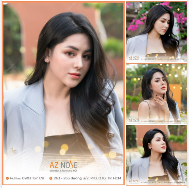 Vẻ đẹp cuốn hút của nàng CEO sau 1 năm tái tạo dáng mũi