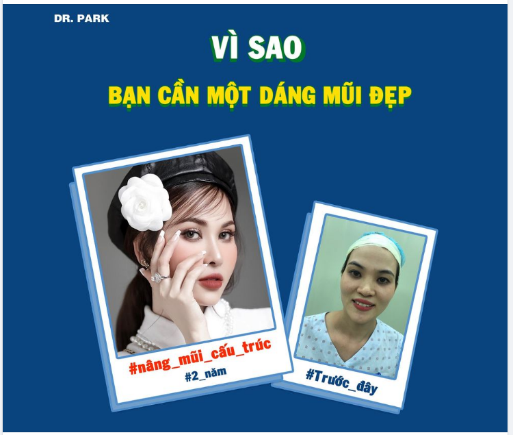 VÌ SAO BẠN CẦN MỘT DÁNG MŨI ĐẸP