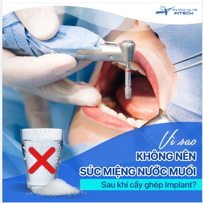 VÌ SAO KHÔNG NÊN SÚC MIỆNG NƯỚC MUỐI SAU KHI CẤY GHÉP IMPLANT?