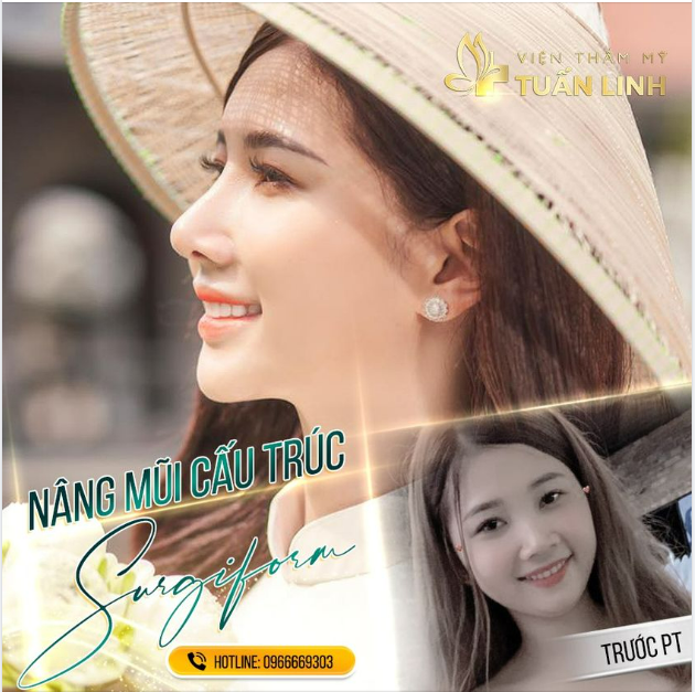 VÌ SAO SỤN SURGIFORM ĐƯỢC KHÁCH HÀNG TIN CHỌN