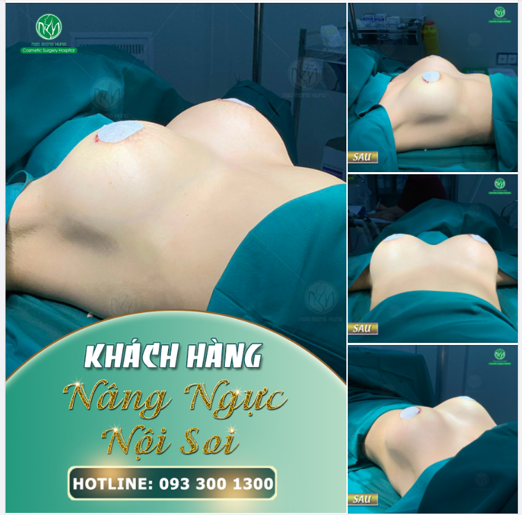 VÒNG 1 ĐẸP NGAY SAU THỰC HIỆN