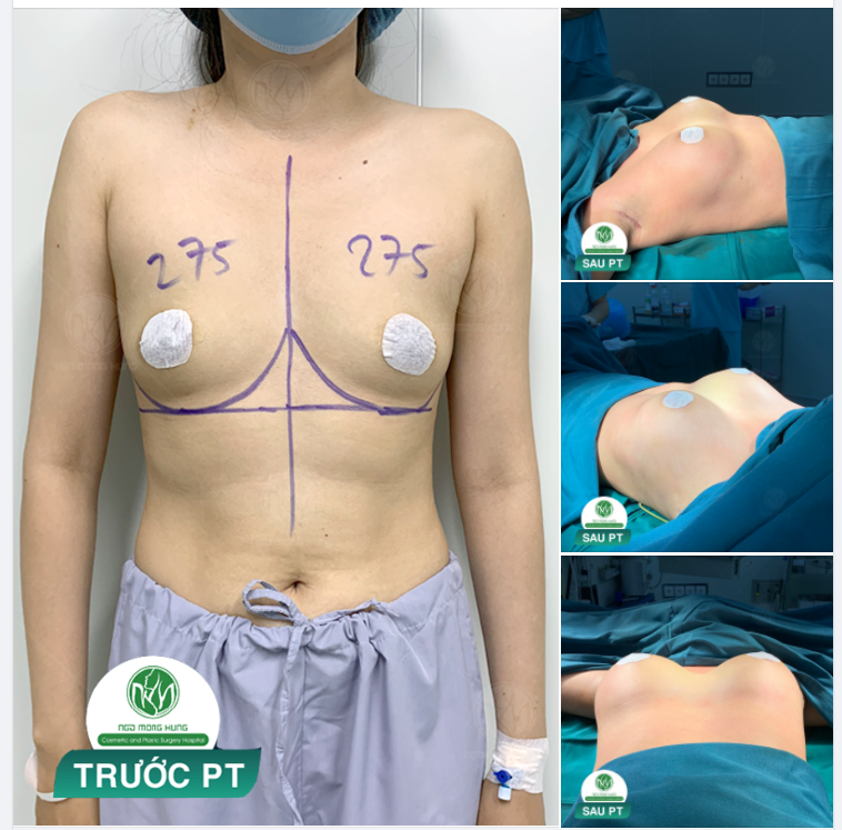 ...VỪA ĐỦ TỰ NHIÊN LÀ ĐƯỢC RỒI Ạ ...