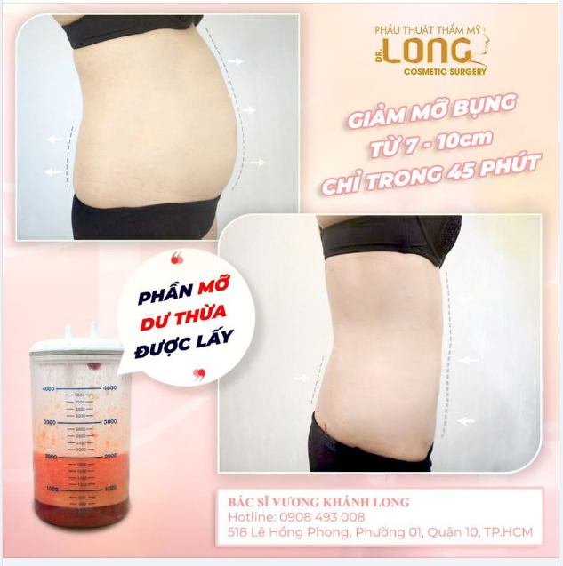 VUI HÈ CỰC ĐÃ KHI SỞ HỮU VÓC DÁNG THON THẢ