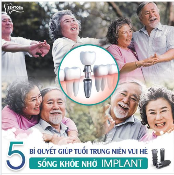 VUI HÈ SỐNG KHOẺ VỚI IMPLANT