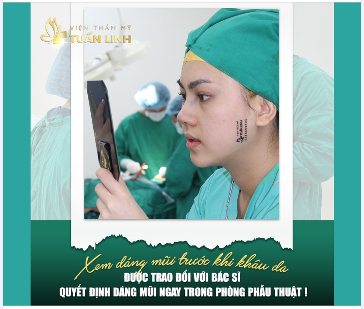 Xem dáng mũi trước khi khâu da - Đọc quyền khi thực hiện nâng mũi tại Tuấn Linh  
