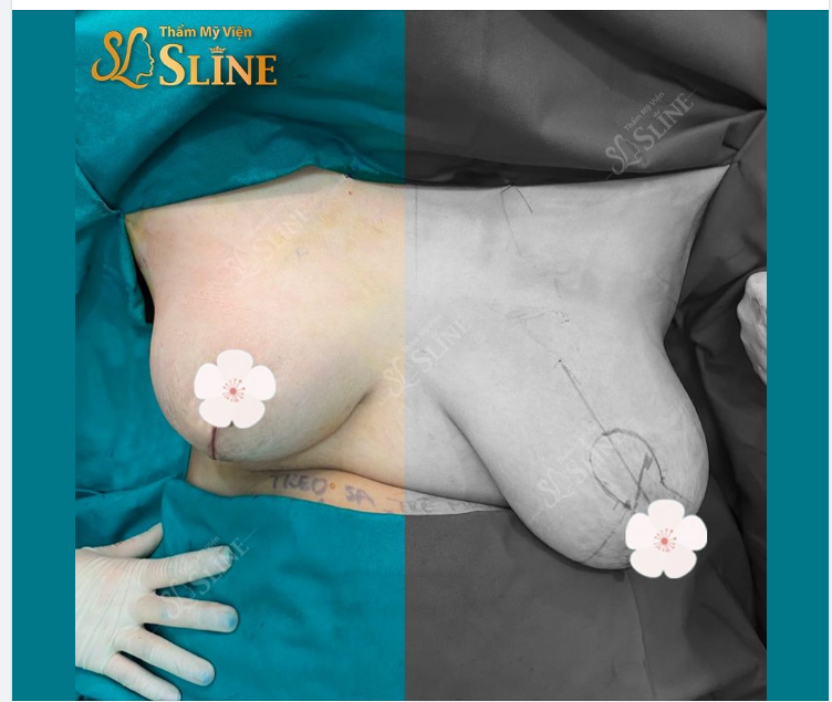 XÓA TAN MỌI NỖI LO KHI ĐẾN VỚI SLINE.