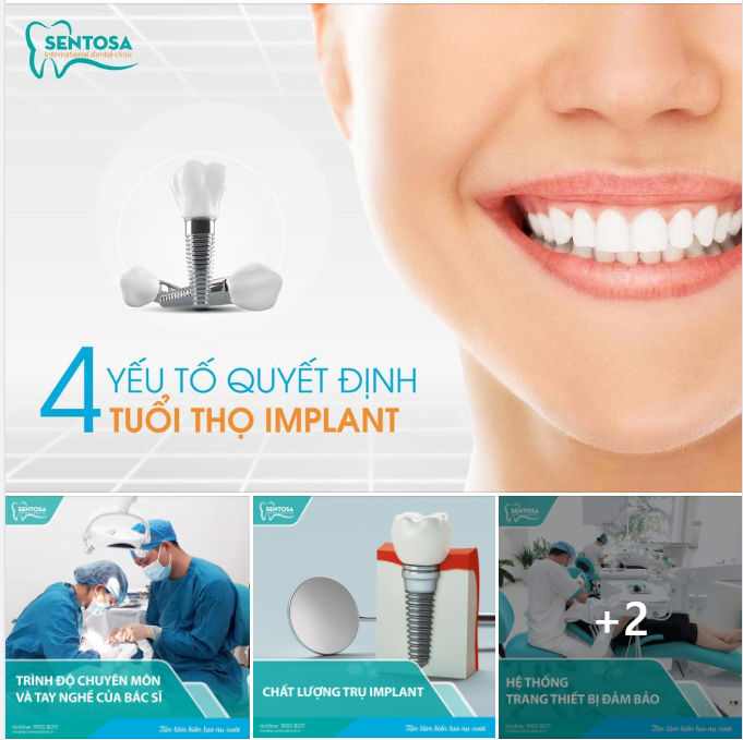 YẾU TỐ QUYẾT ĐỊNH 1 CA TRỒNG RĂNG IMPLANT THÀNH CÔNG