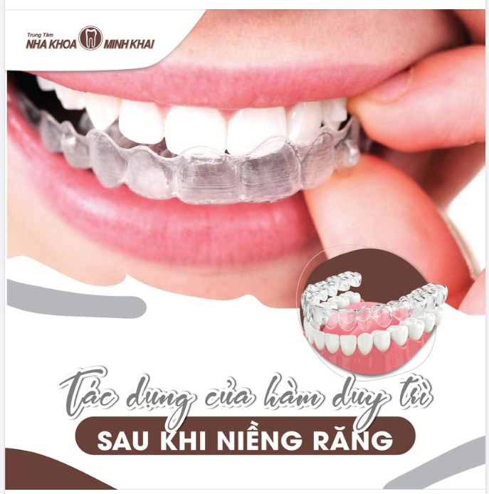 3 CÔNG DỤNG CỦA HÀM DUY TRÌ SAU NIỀNG RĂNG BẠN CẦN BIẾT
