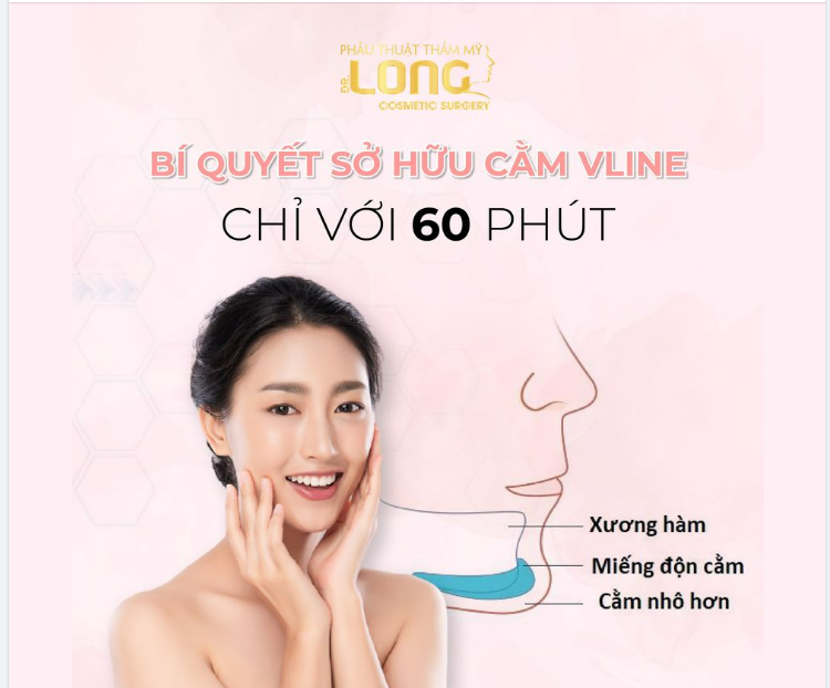 60 phút có ngay khuôn mặt V-line xinh đẹp