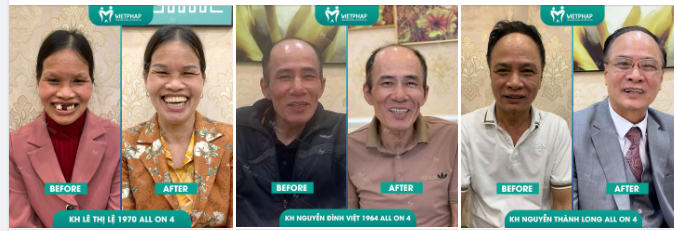 AI NÓI NGƯỜI GIÀ KHÔNG THỂ ĂN CẢ THẾ GIỚI?