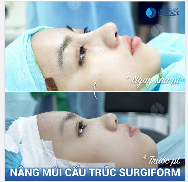 AI NÓI TỐT GỖ HƠN TỐT NƯỚC SƠN Gỗ Hay Sơn Đều Có Giá Trị!