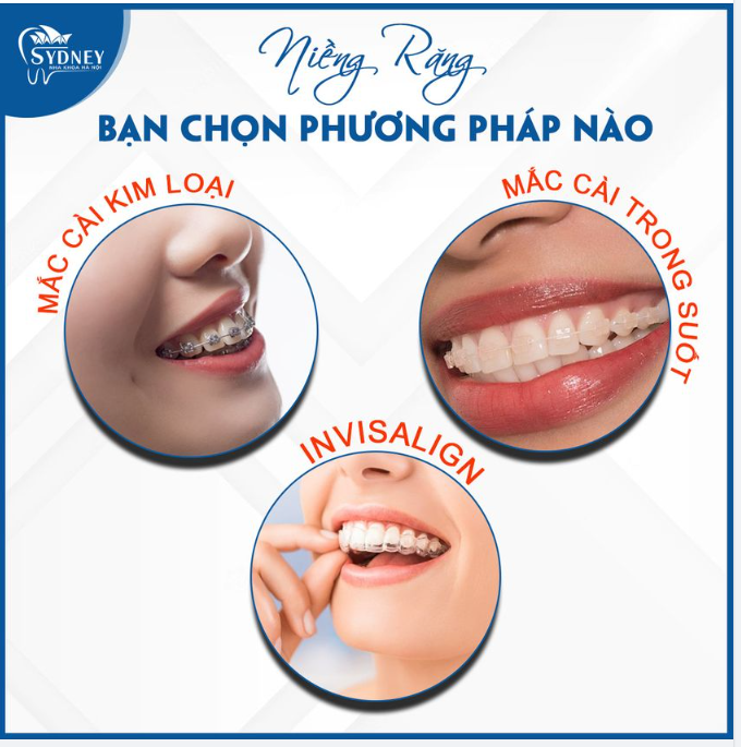 BẠN CHỌN GÌ CHO HÀNH TRÌNH NIỀNG RĂNG CỦA MÌNH