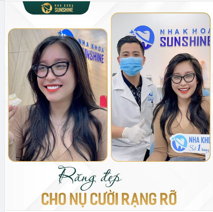 Bạn muốn sở hữu một nụ cười đẹp nhưng ngại niềng răng vì mất quá nhiều thời gian.