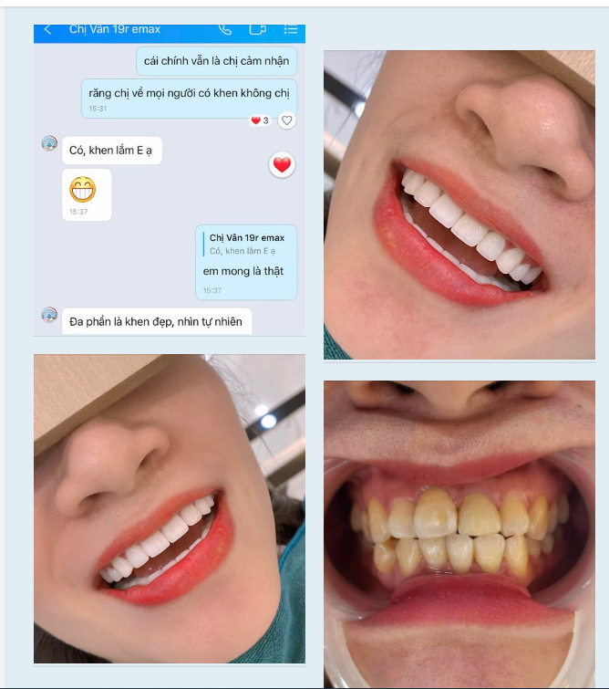 Bảo chứng lớn nhất của Delia chính là nụ cười hoàn mỹ và sự tin yêu của khách hàng