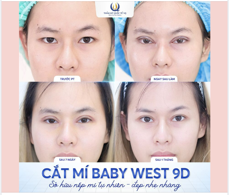 Bí kíp SỞ HỮU NẾP MÍ VẠN NGƯỜI MÊ