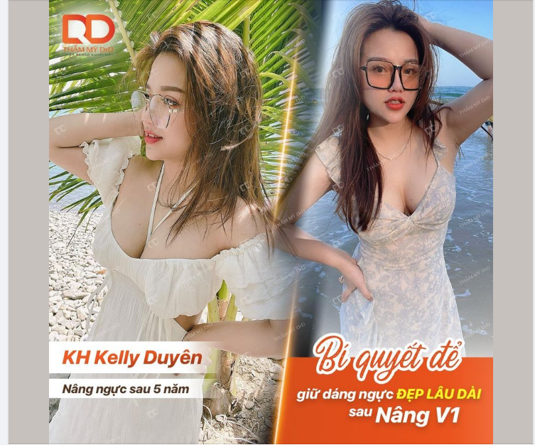 BÍ QUYẾT ĐỂ GIỮ DÁNG NGỰC ĐẸP LÂU DÀI SAU NÂNG V1