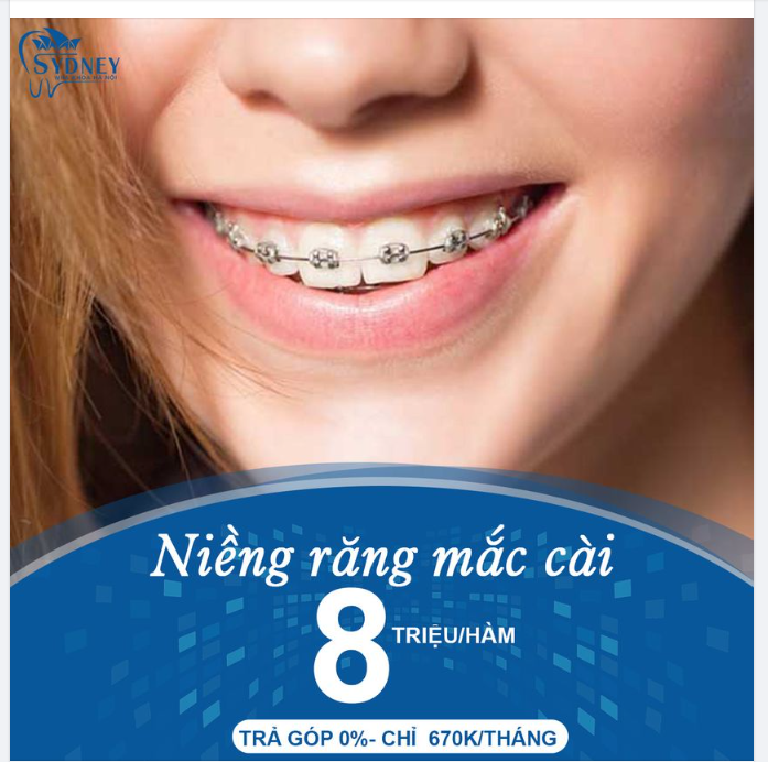 BÍ QUYẾT GIÚP HỘI NIỀNG RĂNG THOẢI MÁI ĂN NGON