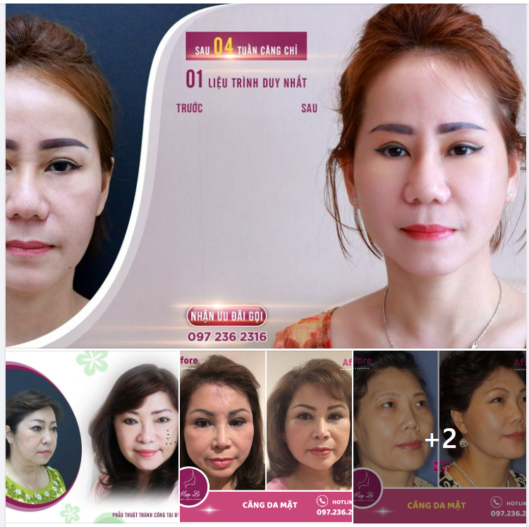 BÍ QUYẾT TRẺ HÓA DA KHÔNG PHẢI AI CŨNG BIẾT