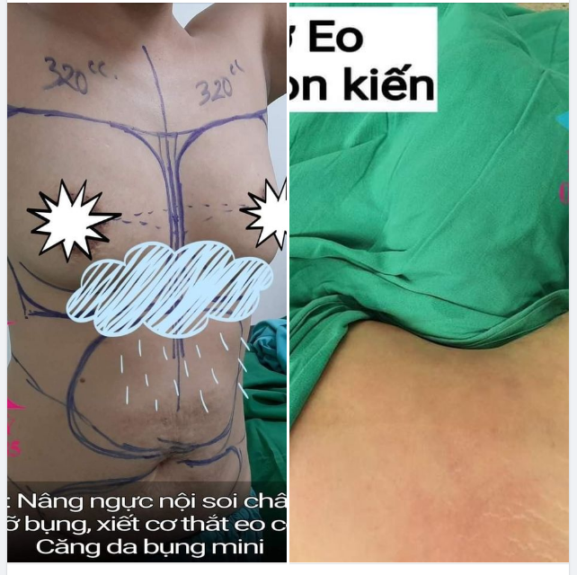 BODY THON GỌN - TỰ TIN SẢI BƯỚC