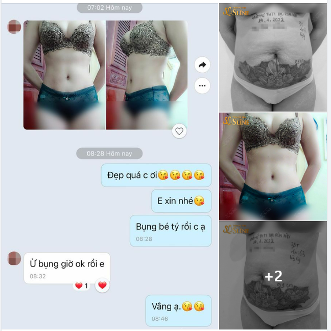 Bụng chị giờ ok rồi em