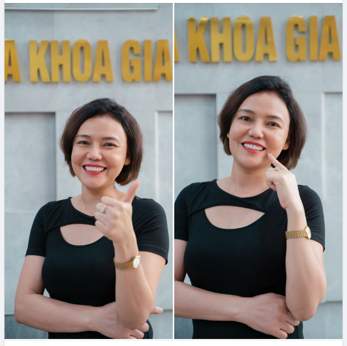 BỪNG SÁNG NỤ CƯỜI - NHAN SẮC THĂNG HẠNG NHỜ THẨM MỸ RĂNG SỨ