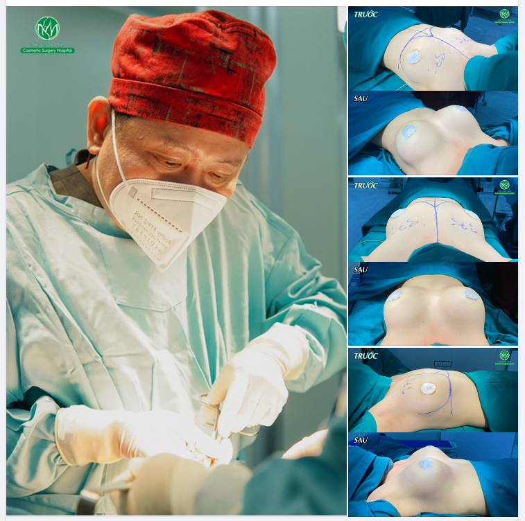 CA NÂNG NGỰC NỘI SOI CUỐI NGÀY