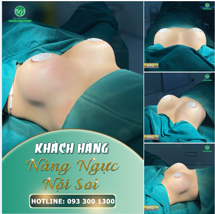 CA NGỰC SIÊU GỢI CẢM CHO KH
