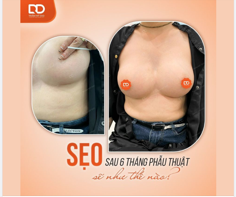 Các nàng thường sợ sẹo sau phẫu thuật đúng không
