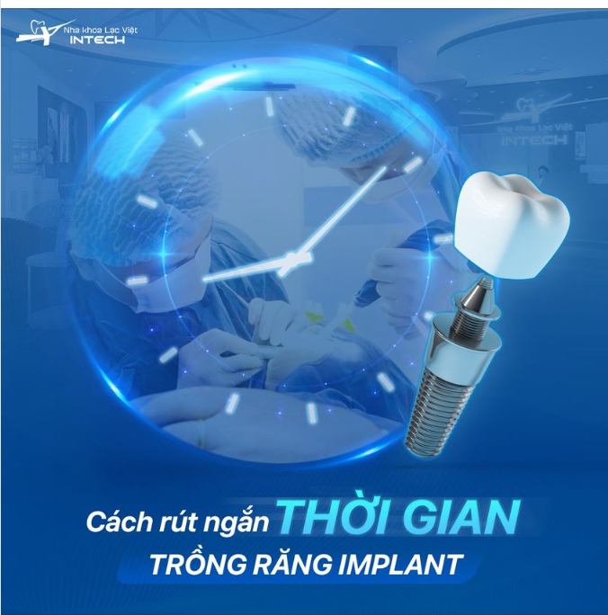 CÁCH RÚT NGẮN THỜI GIAN TRỒNG RĂNG IMPLANT