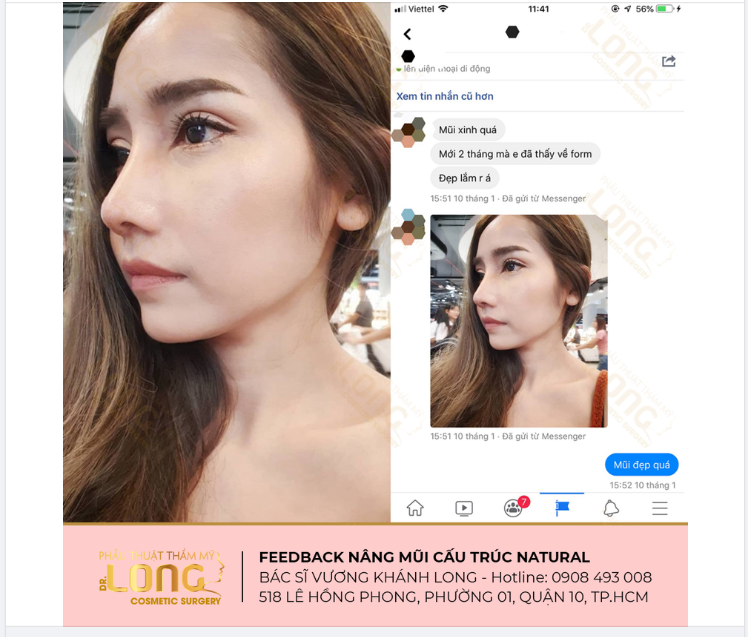 CÁI ĐẸP LẤN ÁT CÁI ĐAU….KHÔNG SAO NÊN ĐỪNG SỢ​​​​​​​.
