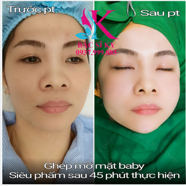 CÁI GÌ CŨNG CÓ MẶT TRÁI- MẶT PHẢI, CHỈ CÓ MẶT CỦA KHÁCH NHÀ BÁC SĨ KỲ LÀ ĐÁNG YÊU THÔI...