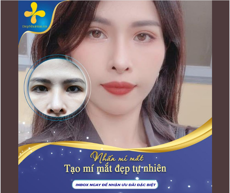 Cải thiện Cửa sổ tâm hồn với phương pháp NHẤN MÍ đẹp tự nhiên