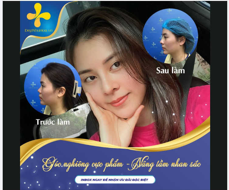 CẢI THIỆN MỘT ĐIỂM DUY NHẤT TRÊN GƯƠNG MẶT, CÔ GÁI 9X LỘT XÁC NGOẠN MỤC