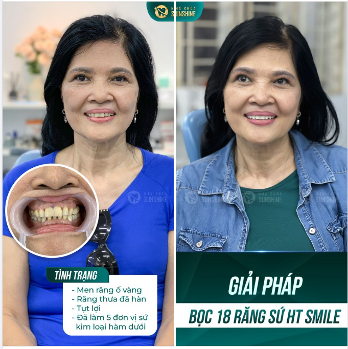 Cần khắc phục càng sớm càng tốt để không ảnh hưởng đến sức khoẻ bản thân.