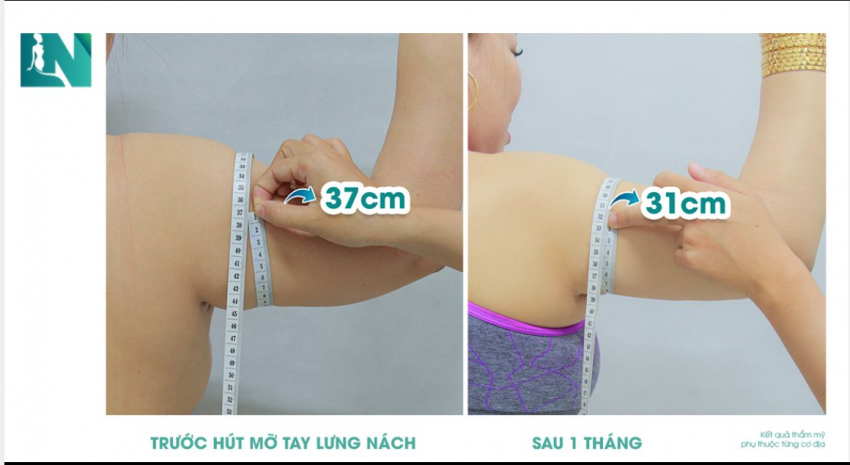 CÁNH TAY THON NUỘT – GIẢM 6CM DỄ DÀNG SAU 60 PHÚT!